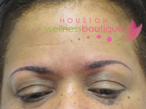 brows