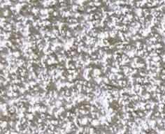 Popcorn Acoustic Ceiling Removal